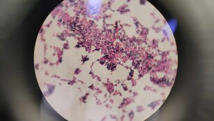 obserwacje mikroskopowe kolonii bakterii gram dodatnich i ujemnych